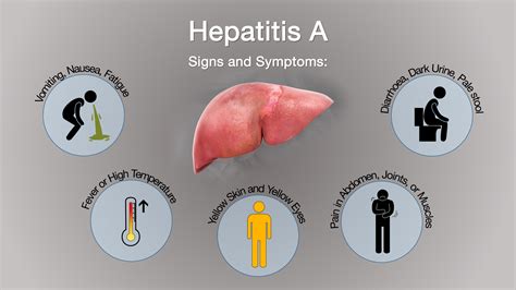 Hepatitis A .